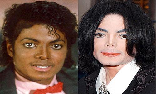 Michael Jackson  plastic surgery before and after