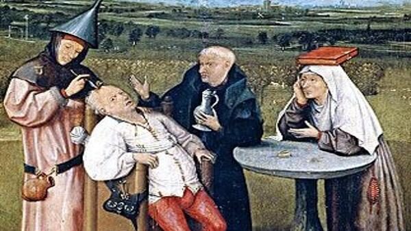 Trepanning